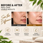 Vitamin C Facial Kit - 6 Step Facial Kit | 2 Time Use